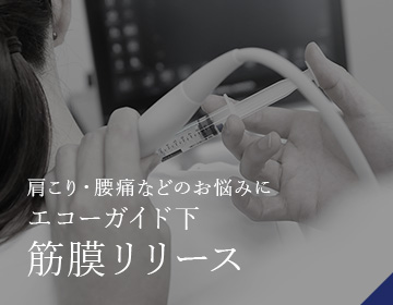 肩こり・腰痛などのお悩みに エコーガイド下筋膜リリース